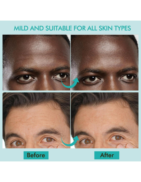 Parches Antienvejecimiento para Arrugas en la Frente AUSLKA 24PCS Parches Antienvejecimiento para Arrugas en la Frente AUSLKA 24PCS