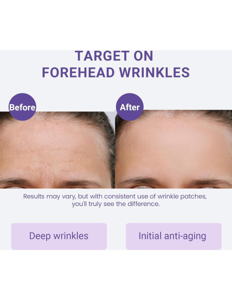 Parche Antienvejecimiento Sfuchin para Arrugas en la Frente 20 Pcs