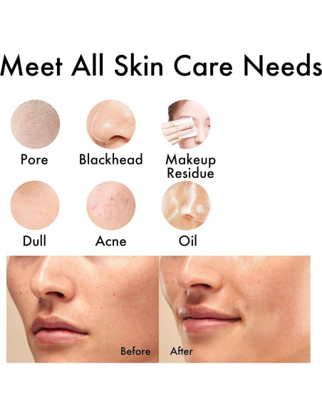 Exfoliador Facial NagraCoola Eléctrico Impermeable 2 Cabezas