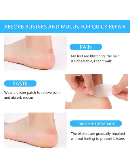 24 Almohadillas para Tacones Qullmartle - Comodidad y Ajuste