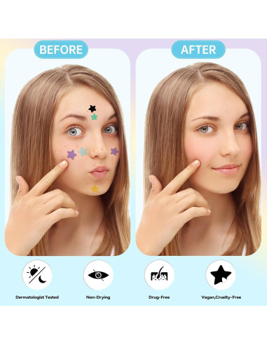 Parche para Granos Estrella Waspot - 240 Unidades Hidrocoloide