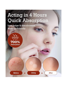 Parche Hidrocoloide para Espinillas AIDENLAB 110 Unidades 2