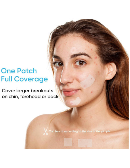 Parche para Acné Rulvcian - 18 Microdart + 16 Grandes