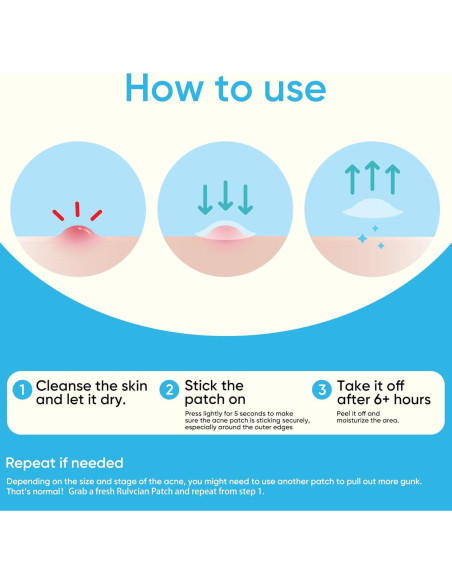 Parche para Acné Rulvcian - 18 Microdart + 16 Grandes