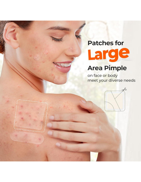 Parches Hidrocoloide TKTK 120 Unidades 45x45mm para Granitos