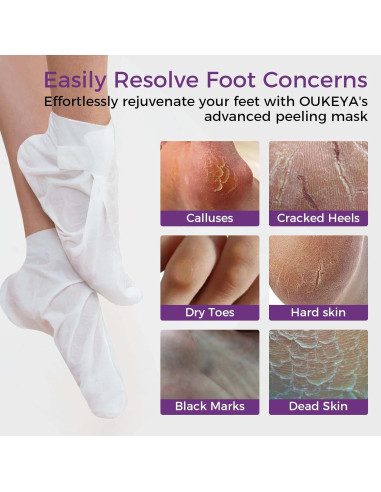 Mascarilla Exfoliante para Pies OUKEYA - 3 Pares, Lavanda