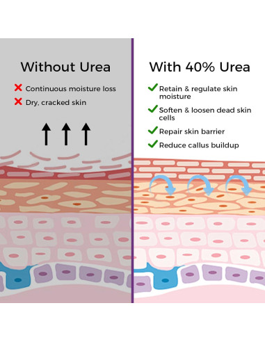 Mascarilla Exfoliante para Pies OUKEYA - 3 Pares, Lavanda