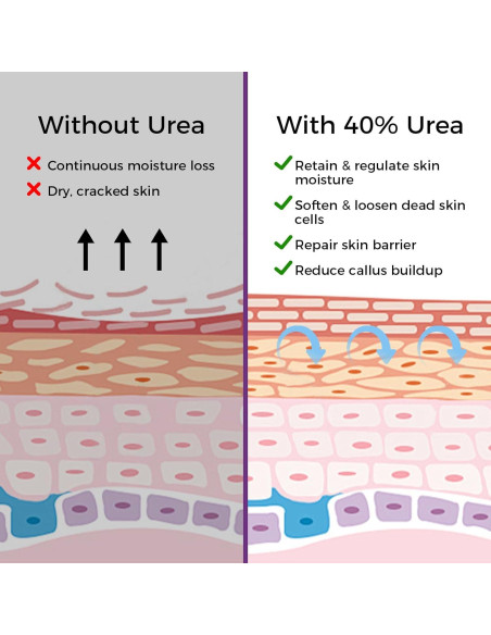Mascarilla Exfoliante para Pies OUKEYA - 3 Pares, Lavanda