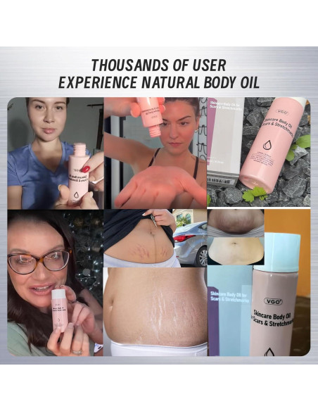 Aceite Corporal VGO 50 ml con Vitamina E para Piel Suave