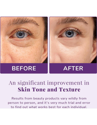 Almohadillas Faciales ANAI RUI Niacinamida 50 Unidades