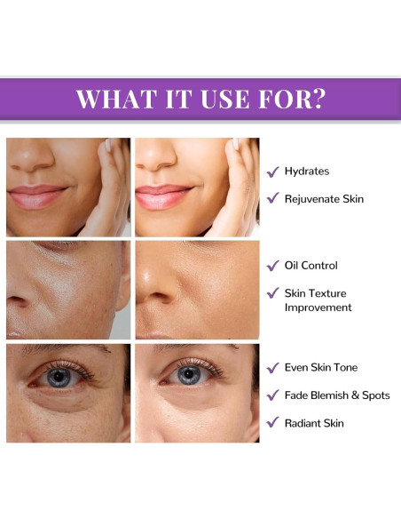 Almohadillas Faciales ANAI RUI Niacinamida 50 Unidades