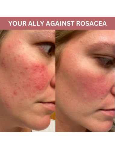 Mascarilla Peel Off Matcha CocoBeauty - Hidratante y Calmante (4 unidades)