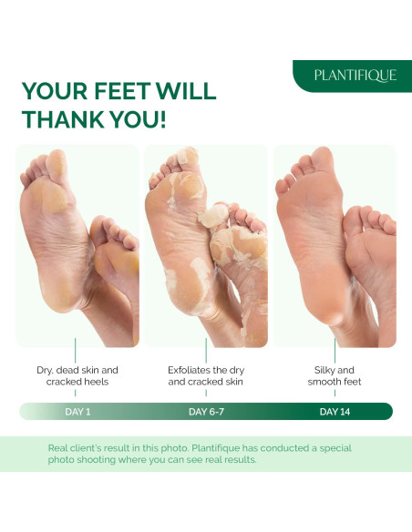 Mascarilla Exfoliante para Pies Plantifique Aloe Vera 2 Paquetes