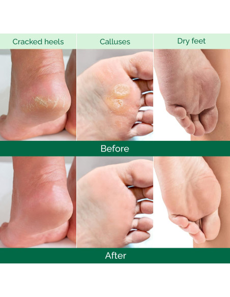 Mascarilla Exfoliante para Pies Plantifique Aloe Vera 2 Paquetes