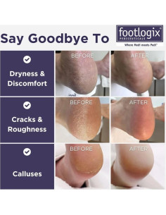 Suavizante de Callos Footlogix + Lima Doble Cara 1 Cuenta 2