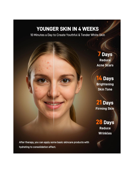 Máscara de Terapia de Luz Roja MICEYLIVE con 400 LEDs y 6 Modos