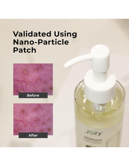 Aceite Limpiador de Poros Jozy 200ml - Desmaquillante Suave