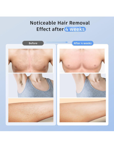 Depiladora láser IPL Ubroo indolora con enfriamiento 5C