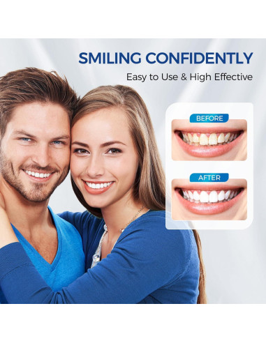 Kit de Gel Blanqueador Dental Toos Show 5 x 3ml Sin Sensibilidad