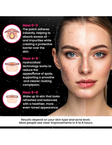 Parches Hidrocoloides Estrella Andlane - 280 Pcs, 3 Tamaños