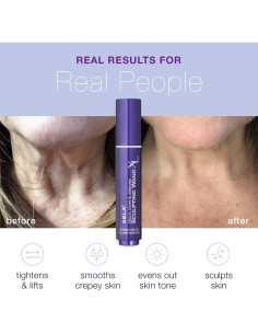 Varita Esculpidora de Cuello SBLA XL - Antienvejecimiento 20.7 ml 2