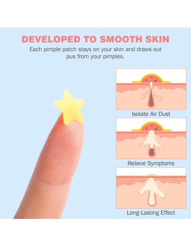 Parches para Granos HLOES 279PCS Hidrocoloide Estrella