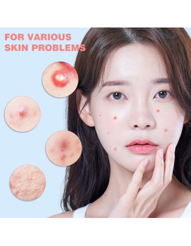 Parches para Granos HLOES 279PCS Hidrocoloide Estrella