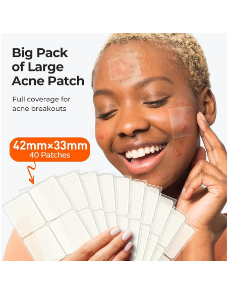 Parches para Acné TKTK Hidrocoloide Grande 92 Piezas 5 Tamaños Parches para Acné TKTK Hidrocoloide Grande 92 Piezas 5 Tamaños