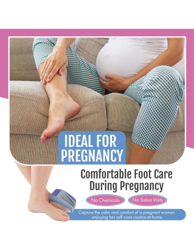 Exfoliador de Pies 3 en 1 Wonex - Removedor de Callos Gris