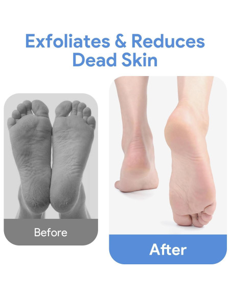 Alfombrilla Exfoliante para Pies de Ducha Yuuchoringee Azul