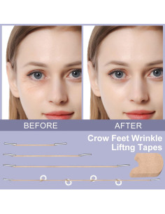 Cintas Elevadoras para Arrugas en Ojos Moonlight-ybh - 4 Cuerdas Fijas 2