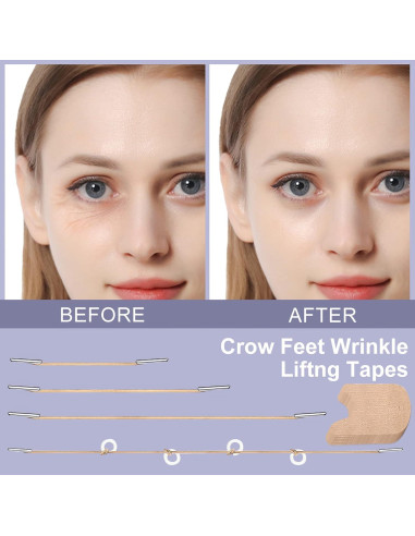 Cintas Elevadoras para Arrugas en Ojos Moonlight-ybh - 4 Cuerdas Fijas