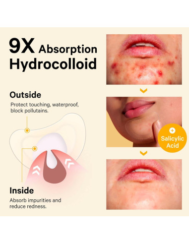 Parche para Granos en la Barbilla Sosky - Hidrocoloides 12 Unidades