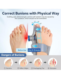 Corrector de Juanetes Ajustable ROHVEMJ - Alivio para Pies 2