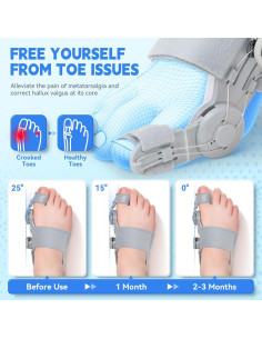 Corrector de Juanetes SHIADA Ajustable con Almohadilla de Silicona 2