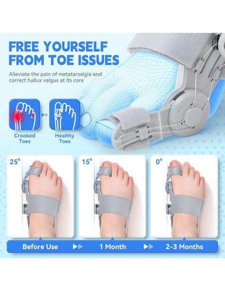 Corrector de Juanetes SHIADA Ajustable con Almohadilla de Silicona