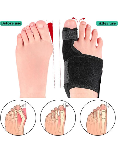 Corrector de Juánete YHOUMEW Pie Izquierdo Ajustable Alivio Dolor
