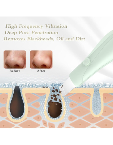 Raspador Facial Portátil Auioytoy K2405 - Eliminación de Puntos Negros