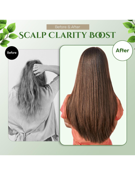 Juego de Champú y Acondicionador Sin Sulfatos SARABiO 760g