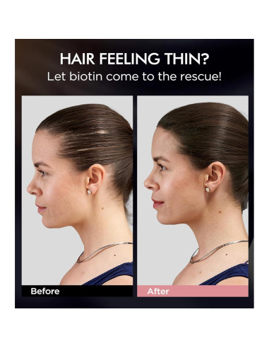 Juego de Champú y Acondicionador Srripo Biotina 2 x 500ml