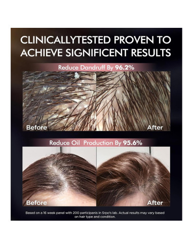 Juego de Champú y Acondicionador Srripo Biotina 2 x 500ml