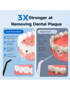 Irrigador Dental Portátil Prooral F42-F1-02 300ml Negro 2