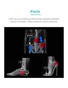Plantillas de Soporte Arqueado CURING CO. para Hombres y Mujeres 2