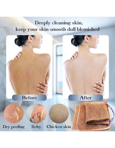 Antallcky 3 Esponjas Exfoliantes Africanas para Baño Antallcky 3 Esponjas Exfoliantes Africanas para Baño