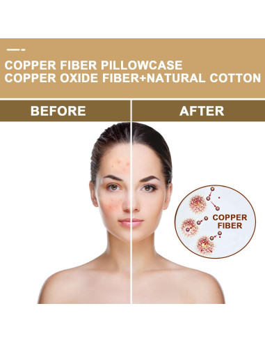 Funda de Almohada de Cobre VEJESIME 70x48cm Oro Antienvejecimiento