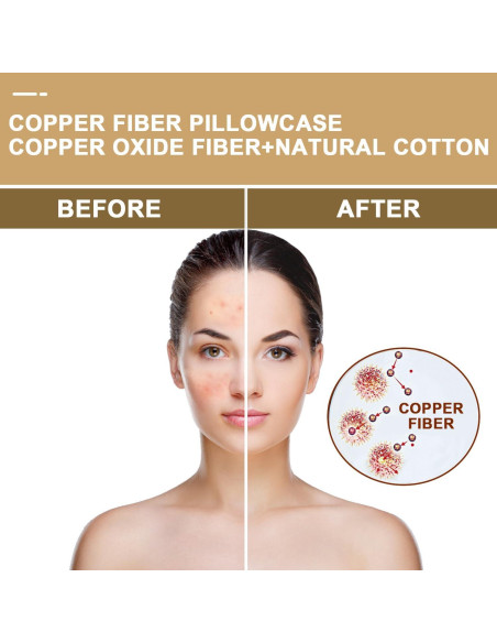 Funda de Almohada de Cobre VEJESIME 70x48cm Oro Antienvejecimiento Funda de Almohada de Cobre VEJESIME 70x48cm Oro Antienvejecimiento