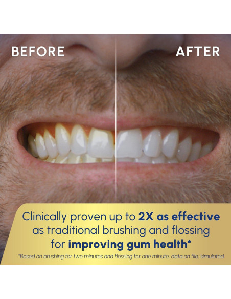 Cepillo de dientes eléctrico Waterpik Sonic-Fusion 2.0 Negro