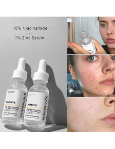 Suero Facial Niacinamida 10% + Zinc 1% MIZEEYE 80g 2
