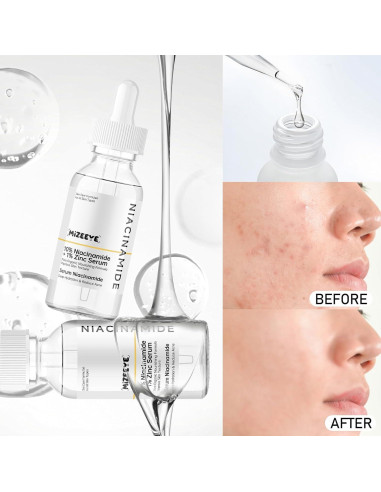 Suero Facial Niacinamida 10% + Zinc 1% MIZEEYE 80g