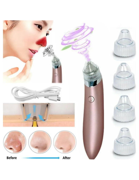 Aspiradora Eléctrica de Puntos Negros ZENARA AS23DT6 - Limpieza Profunda